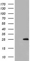 GSTA4 Antibody - HEK293T cells were transfected with the pCMV6-ENTRY control (Left lane) or pCMV6-ENTRY GSTA4 (Right lane) cDNA for 48 hrs and lysed. Equivalent amounts of cell lysates (5 ug per lane) were separated by SDS-PAGE and immunoblotted with anti-GSTA4.