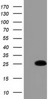 GSTA4 Antibody - HEK293T cells were transfected with the pCMV6-ENTRY control (Left lane) or pCMV6-ENTRY GSTA4 (Right lane) cDNA for 48 hrs and lysed. Equivalent amounts of cell lysates (5 ug per lane) were separated by SDS-PAGE and immunoblotted with anti-GSTA4.