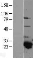 GSTA4 Protein - Western validation with an anti-DDK antibody * L: Control HEK293 lysate R: Over-expression lysate
