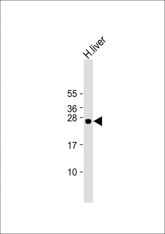 GSTA5 Antibody - Anti-GSTA5 Antibody (Center) at 1:2000 dilution + human liver lysate Lysates/proteins at 20 µg per lane. Secondary Goat Anti-Rabbit IgG, (H+L), Peroxidase conjugated at 1/10000 dilution. Predicted band size: 26 kDa Blocking/Dilution buffer: 5% NFDM/TBST.
