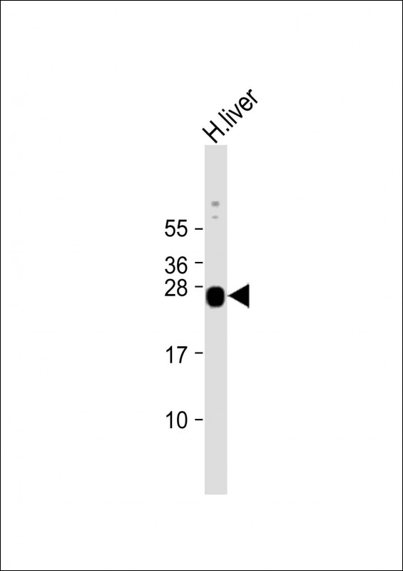 GSTA5 Antibody - Anti-GSTA5 Antibody (N-Term) at 1:2000 dilution + human liver lysate Lysates/proteins at 20 µg per lane. Secondary Goat Anti-Rabbit IgG, (H+L), Peroxidase conjugated at 1/10000 dilution. Predicted band size: 26 kDa Blocking/Dilution buffer: 5% NFDM/TBST.