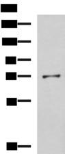 GSTCD Antibody - Western blot analysis of K562 cell lysate  using GSTCD Polyclonal Antibody at dilution of 1:800