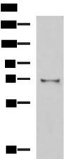 GSTCD Antibody - Western blot analysis of Mouse kidney tissue lysate  using GSTCD Polyclonal Antibody at dilution of 1:1000