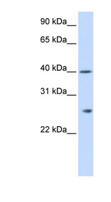 GSTK1 Antibody - GSTK1 antibody Western blot of Fetal Liver lysate. This image was taken for the unconjugated form of this product. Other forms have not been tested.