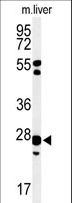 GSTK1 Antibody - Western blot of GSTK1 Antibody in mouse liver tissue lysates (35 ug/lane). GSTK1 (arrow) was detected using the purified antibody.