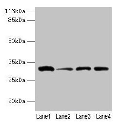 GSTK1 Antibody - Western blot All lanes: Glutathione S-transferase kappa 1 antibody at 2µg/ml Lane 1: 293T whole cell lysate Lane 2: Hela whole cell lysate Lane 3: A431 whole cell lysate Lane 4: COLO205 whole cell lysate Secondary Goat polyclonal to rabbit IgG at 1/10000 dilution Predicted band size: 26, 32, 25, 21 kDa Observed band size: 26 kDa