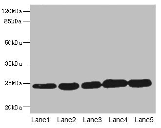 GSTK1 Antibody - Western blot All Lanes: GSTK1 antibody at 0.51ug/ml Lane 1: MCF7 whole cell lysate Lane 2: K562 whole cell lysate Lane 3: Hela whole cell lysate Lane 4: HepG-2 whole cell lysate Lane 5: Raji whole cell lysate Secondary Goat polyclonal to rabbit IgG at 1/10000 dilution Predicted band size: 26,32,25,21 kDa Observed band size: 25 kDa