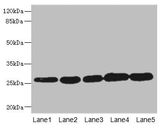 GSTK1 Antibody - Western blot All lanes: GSTK1 antibody at 0.51µg/ml Lane 1: MCF-7 whole cell lysate Lane 2: K562 whole cell lysate Lane 3: Hela whole cell lysate Lane 4: HepG2 whole cell lysate Lane 5: Raji whole cell lysate Secondary Goat polyclonal to rabbit IgG at 1/10000 dilution Predicted band size: 26, 32, 25, 21 kDa Observed band size: 26 kDa