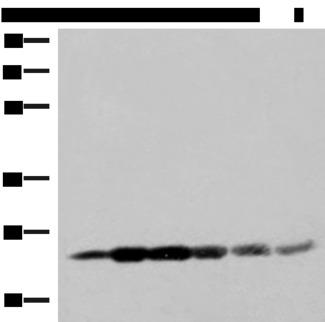 GSTK1 Antibody - Western blot analysis of 293T cell lysates  using GSTK1 Polyclonal Antibody at dilution of 1:250
