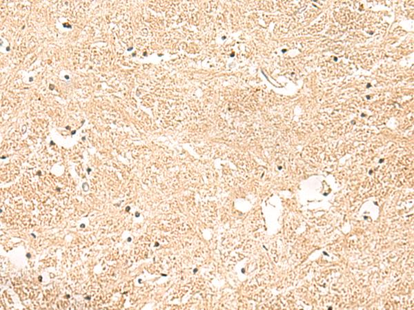 GSTK1 Antibody - Immunohistochemistry of paraffin-embedded Human brain tissue  using GSTK1 Polyclonal Antibody at dilution of 1:50(×200)