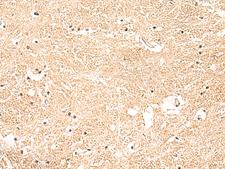 GSTK1 Antibody - Immunohistochemistry of paraffin-embedded Human brain tissue  using GSTK1 Polyclonal Antibody at dilution of 1:50(×200)
