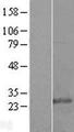 GSTK1 Protein - Western validation with an anti-DDK antibody * L: Control HEK293 lysate R: Over-expression lysate