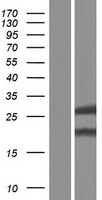 GSTK1 Protein - Western validation with an anti-DDK antibody * L: Control HEK293 lysate R: Over-expression lysate