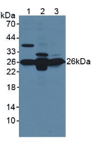 GSTM1 Antibody