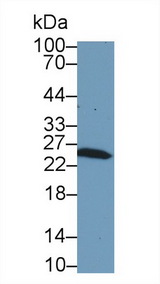 GSTM1 Antibody