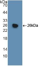 GSTM1 Antibody - Western Blot; Sample: Recombinant GSTm1, Human.