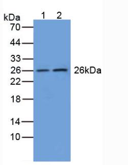 GSTM1 Antibody - Western Blot; Sample: Lane1: Human Liver Tissue; Lane2: Rat Brain Tissue.