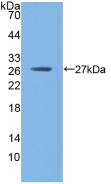 GSTM1 Antibody