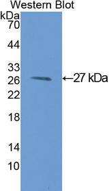 GSTM1 Antibody