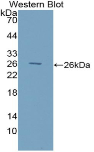 GSTM1 Antibody - Western blot of recombinant GSTM1 / MU. This image was taken for the unconjugated form of this product. Other forms have not been tested.