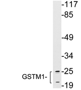 GSTM1 Antibody - Western blot analysis of lysates from HepG2 cells, using GSTM1 antibody.