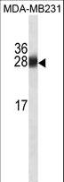 GSTM1 Antibody - GSTM1 Antibody western blot of MDA-MB231 cell line lysates (35 ug/lane). The GSTM1 antibody detected the GSTM1 protein (arrow).