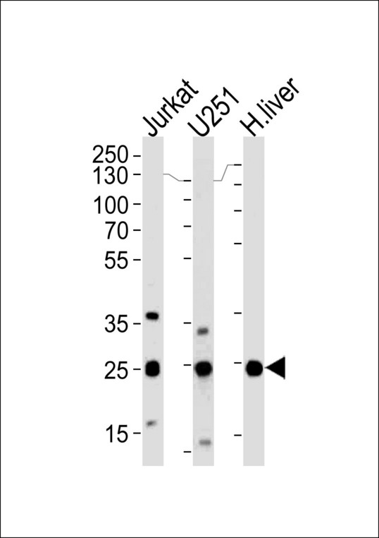 GSTM1 Antibody - Western blot of lysates from Jurkat, U251 cell line and human liver tissue (from left to right), using GSTM1 Antibody. Antibody was diluted at 1:1000 at each lane. A goat anti-rabbit (HRP) at 1:5000 dilution was used as the secondary antibody. Lysates at 35ug per lane.