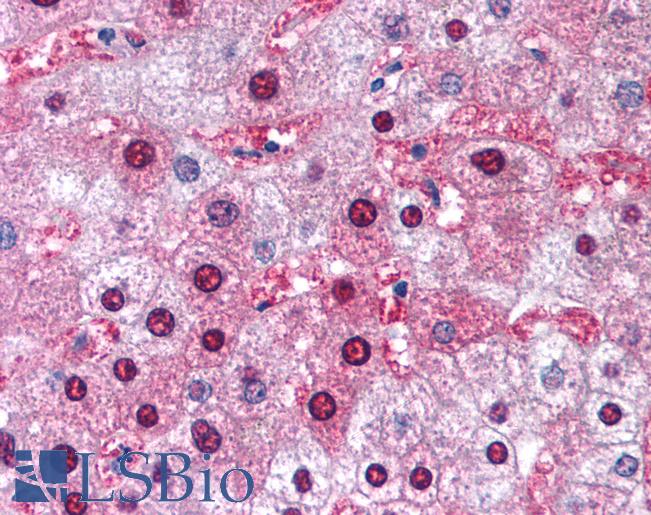 GSTM1 Antibody - Anti-GSTM1 antibody IHC of human liver. Immunohistochemistry of formalin-fixed, paraffin-embedded tissue after heat-induced antigen retrieval. Antibody concentration 5 ug/ml.  This image was taken for the unconjugated form of this product. Other forms have not been tested.