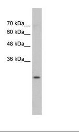 GSTM1 Antibody - Jurkat Cell Lysate.  This image was taken for the unconjugated form of this product. Other forms have not been tested.