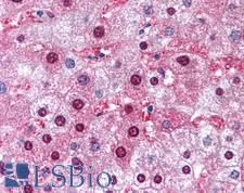 GSTM1 Antibody - Anti-GSTM1 antibody IHC of human liver. Immunohistochemistry of formalin-fixed, paraffin-embedded tissue after heat-induced antigen retrieval. Antibody concentration 5 ug/ml.  This image was taken for the unconjugated form of this product. Other forms have not been tested.