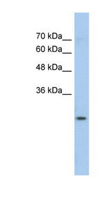 GSTM1 Antibody - GSTM1 antibody Western blot of Jurkat lysate. This image was taken for the unconjugated form of this product. Other forms have not been tested.