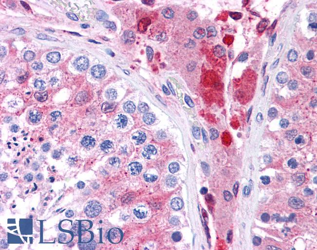 GSTM1 Antibody - Anti-GSTM1 antibody IHC of human testis. Immunohistochemistry of formalin-fixed, paraffin-embedded tissue after heat-induced antigen retrieval. Antibody concentration 5 ug/ml.  This image was taken for the unconjugated form of this product. Other forms have not been tested.