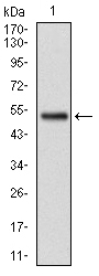 GSTM1 Antibody - Western blot using GSTM1 monoclonal antibody against human GSTM1 (AA: 23-181) recombinant protein. (Expected MW is 25.7 kDa)