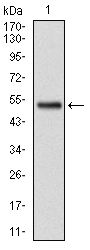 GSTM1 Antibody - GSTM1 Antibody in Western Blot (WB)