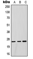 GSTM1 Antibody - Western blot analysis of GSTM1 expression in HeLa (A); HepG2 (B); rat testis (C) whole cell lysates.
