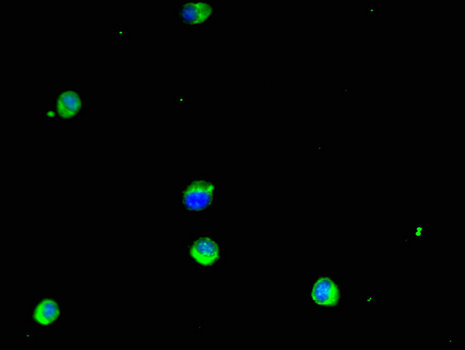 GSTM1 Antibody - Immunofluorescent analysis of Hela cells using GSTM1 Antibody at a dilution of 1:100 and Alexa Fluor 488-congugated AffiniPure Goat Anti-Rabbit IgG(H+L)
