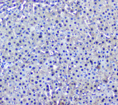 GSTM1 Antibody - IHC analysis of GSTM1 using anti-GSTM1 Antibody. GSTM1 was detected in paraffin-embedded section of rat liver tissue . Heat mediated antigen retrieval was performed in citrate buffer (pH6, epitope retrieval solution) for 20 mins. The tissue section was blocked with 10% goat serum. The tissue section was then incubated with 2µg/ml mouse anti-GSTM1 Antibody overnight at 4°C. Biotinylated goat anti-mouse IgG was used as secondary antibody and incubated for 30 minutes at 37°C. The tissue section was developed using Strepavidin-Biotin-Complex (SABC) with DAB as the chromogen.