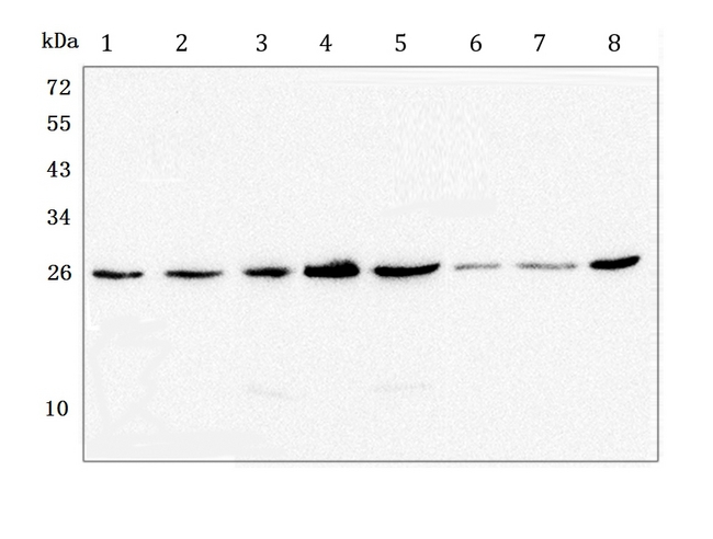 GSTM1 Antibody - Western blot analysis of GSTM1 using anti-GSTM1 Antibody. Electrophoresis was performed on a 5-20% SDS-PAGE gel at 70V (Stacking gel) / 90V (Resolving gel) for 2-3 hours. The sample well of each lane was loaded with 50ug of sample under reducing conditions. Lane 1: human Hela, whole cell lysate, Lane 2: human T-47D whole cell lysate, Lane 3: rat brain tissue lysate, Lane 4: rat lung tissue lysate, Lane 5: rat stomach tissue lysate, Lane 6: mouse lung tissue lysate, Lane 7: mouse stomach tissue lysate, Lane 8: mouse kidney tissue lysate. After Electrophoresis, proteins were transferred to a Nitrocellulose membrane at 150mA for 50-90 minutes. Blocked the membrane with 5% Non-fat Milk/ TBS for 1.5 hour at RT. The membrane was incubated with mouse anti-GSTM1 antigen affinity purified monoclonal antibody at 0.5 µg/mL overnight at 4°C, then washed with TBS-0.1% Tween 3 times with 5 minutes each and probed with a goat anti-mouse IgG-HRP secondary antibody at a dilution of 1:10000 for 1.5 hour at RT. The signal is developed using an Enhanced Chemiluminescent detection (ECL) kit with Tanon 5200 system. A specific band was detected for GSTM1 at approximately 26KD. The expected band size for GSTM1 is at 26KD.