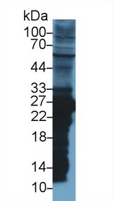 GSTM2 Antibody - Western Blot; Sample: Rat Liver lysate; Primary Ab: 1µg/ml Rabbit Anti-Rat GSTm2 Antibody Second Ab: 0.2µg/mL HRP-Linked Caprine Anti-Rabbit IgG Polyclonal Antibody