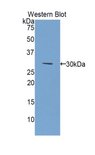 GSTM2 Antibody - Western blot of recombinant GSTM2.  This image was taken for the unconjugated form of this product. Other forms have not been tested.