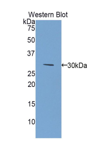 GSTM2 Antibody - Western blot of recombinant GSTM2.  This image was taken for the unconjugated form of this product. Other forms have not been tested.