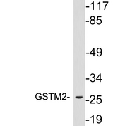 GSTM2 Antibody - Western blot analysis of lysates from 293 cells, using GSTM2 antibody.