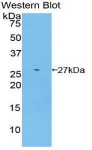 GSTM2 Antibody - Western blot of recombinant GSTM2.  This image was taken for the unconjugated form of this product. Other forms have not been tested.