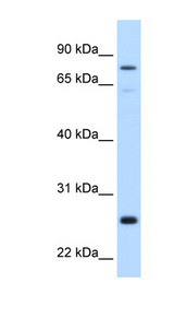 GSTM2 Antibody - GSTM2 antibody Western blot of Fetal Liver lysate. This image was taken for the unconjugated form of this product. Other forms have not been tested.