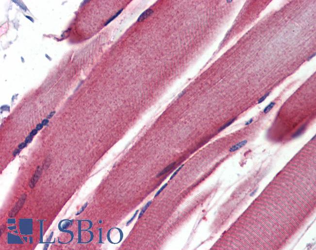 GSTM2 Antibody - Anti-GSTM2 antibody IHC of human skeletal muscle. Immunohistochemistry of formalin-fixed, paraffin-embedded tissue after heat-induced antigen retrieval. Antibody concentration 5 ug/ml.  This image was taken for the unconjugated form of this product. Other forms have not been tested.