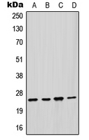 GSTM2 Antibody - Western blot analysis of GSTM2 expression in HepG2 (A); HeLa (B); mouse liver (C); rat liver (D) whole cell lysates.
