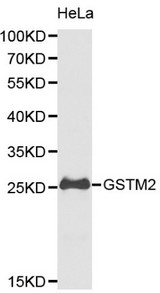 GSTM2 Antibody - Western blot of GSTM2 pAb in extracts from Hela cells.