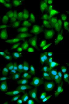 GSTM2 Antibody - Immunofluorescence analysis of HeLa cell using GSTM2 antibody. Blue: DAPI for nuclear staining.