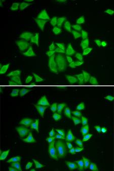 GSTM2 Antibody - Immunofluorescence analysis of A549 cells.