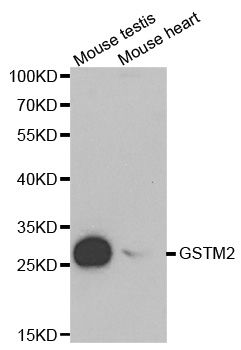 GSTM2 Antibody - Western blot analysis of extracts of various cell lines, using GSTM2 antibody at 1:1000 dilution. The secondary antibody used was an HRP Goat Anti-Rabbit IgG (H+L) at 1:10000 dilution. Lysates were loaded 25ug per lane and 3% nonfat dry milk in TBST was used for blocking.
